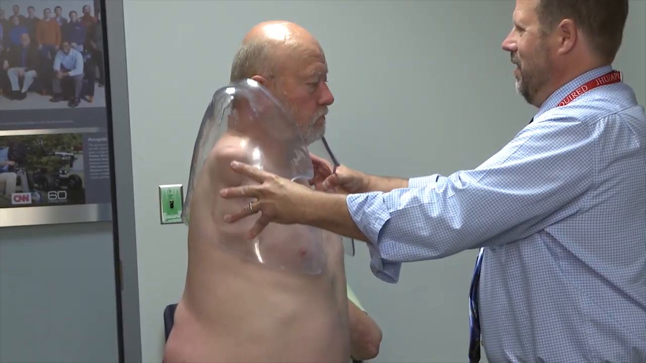 Clinician fitting transparent plastic socket.