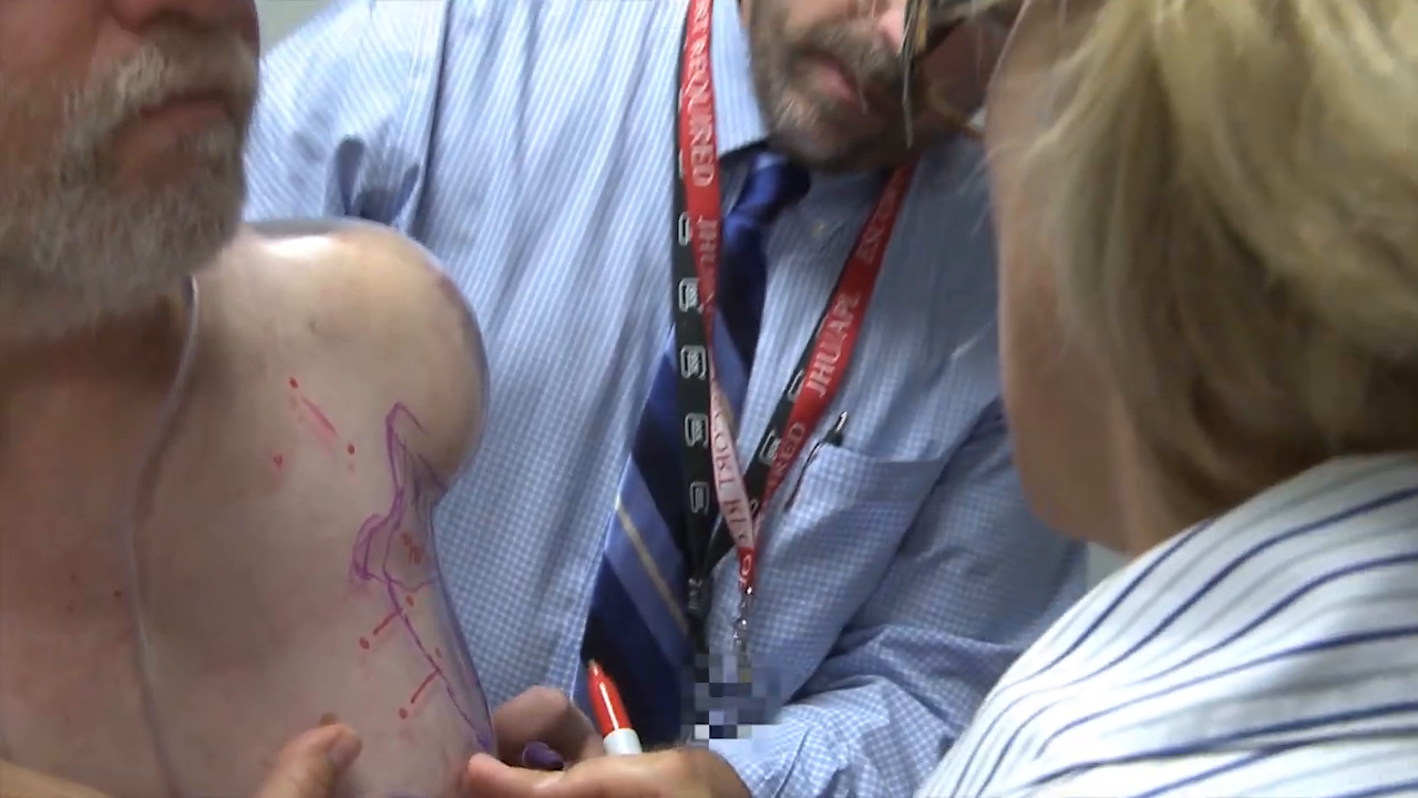 Doctor drawing on patient's skin