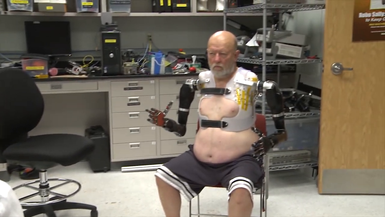 Robotic arms attached to patient